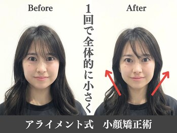 アライメント 自由が丘(Alignment)/全体的に小顔に♪