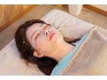 ハウオラ 三軒茶屋(HAUOLA)/整体/美容鍼灸/ヘッドスパ鍼