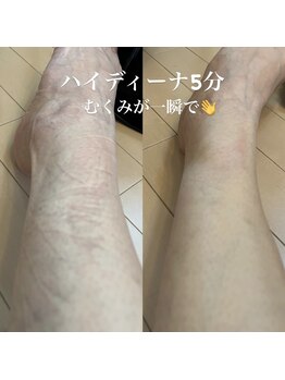ヨサパーク ハナ 六甲道(YOSA PARK HANA)/