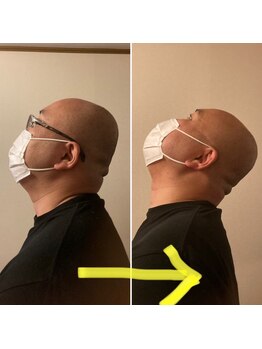 ハチヤBJJスタジオ(HACHIYA BJJ STUDIO)/施術後