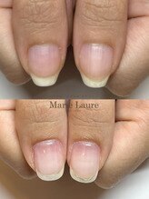 マリーロール 梅田店(Marie Laure)/自爪育成/深爪矯正/ネイルケア