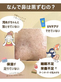 ハピネス 心斎橋アメリカ村本店(Happiness)/疲れやすい、毛穴くすみ気になる