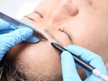 エステビビ 町田店(エステBiBi)/美容電気脱毛の施術の様子♪