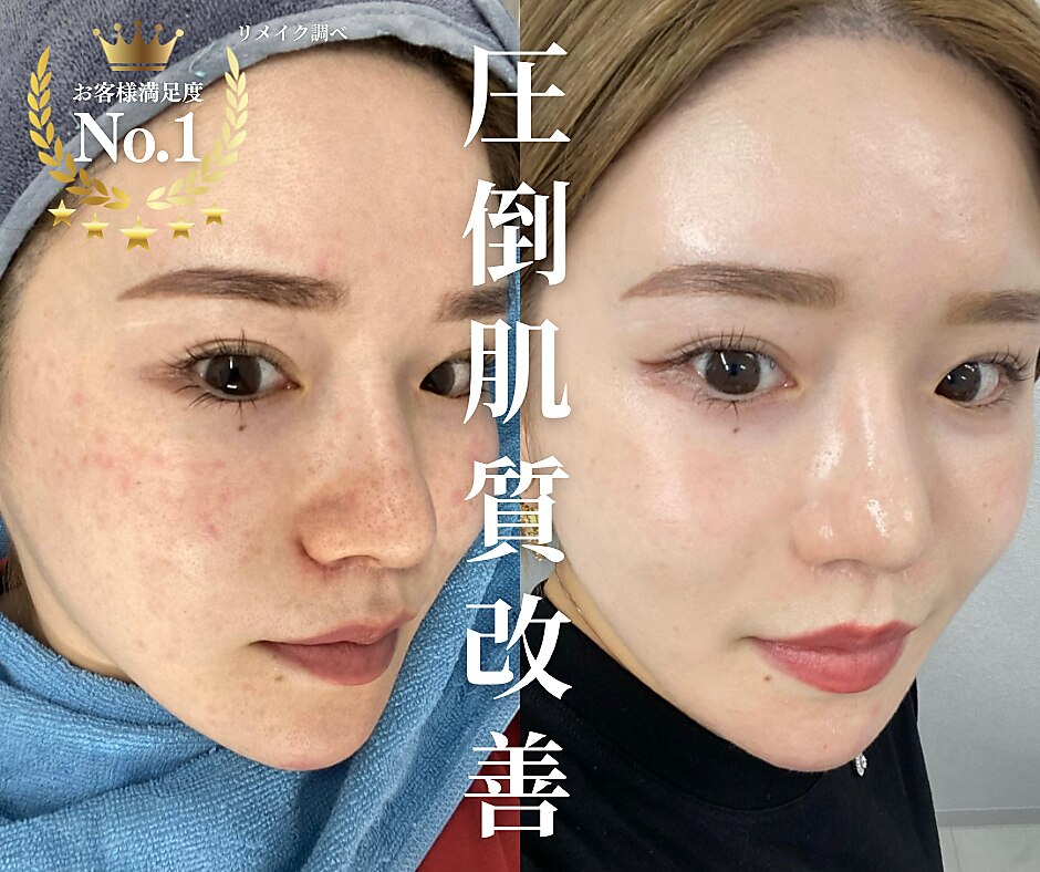 究極の目元リラクゼーションをこの1台で最新最先端万能アイ