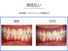 エクシアホワイトニング 岡崎店/Google★5!エリアNo.1の口コミ数