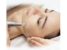 香嬉琉の雰囲気（即感♪毛穴詰まりをしっかり取り除いてダーマエステで引締め）