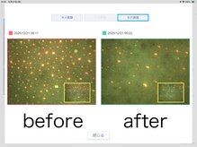 ベベ もりの里店(Be'be')/毛穴汚れの改善例