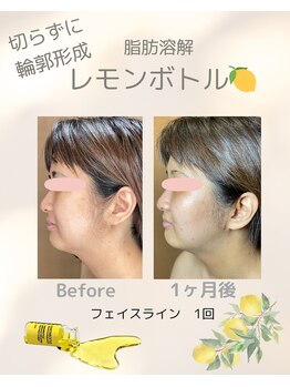 ルーチェ カリーノ(Luce Carino)/レモンボトル（横顔）