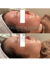 ホープリテーラー 安城店(HOPE Retailer)/施術写真