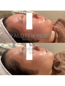 ホープリテーラー 安城店(HOPE Retailer)/施術写真