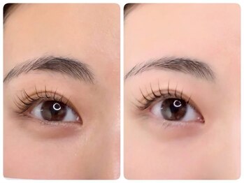 トータルビューティ ノイド(Noid)/パリジェンヌ＆眉WAX脱毛