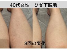 ビモア(Bmore)/★ビフォーアフター★