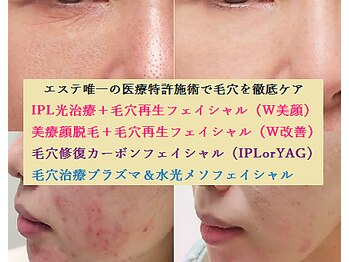 ナチュレアンドメディカ(Nature&Medica)の写真/エステでは難しい開き毛穴、たるみ毛穴、凹凸も徹底改善！修復と同時に生成によりキメも整え毛穴レス水光肌