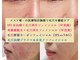 ナチュレアンドメディカ(Nature&Medica)の写真/エステでは難しい開き毛穴、たるみ毛穴、凹凸も徹底改善！修復と同時に生成によりキメも整え毛穴レス水光肌