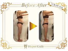 スキニー 六本木店(Skinnie)/51歳女性