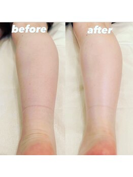 アミ ボディケア(AMI)/［むくみ,こり,整体]神楽坂