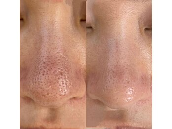 叶(Kanau)/プロセルセラピーズ