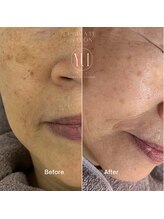 ユイ(YUI)/シミ・シワ・しみ・しわ・老け顔