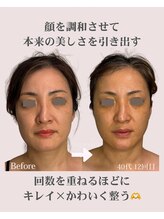 アンジェリカ(Angelica)/黄金バランスへ整顔！立体的小顔