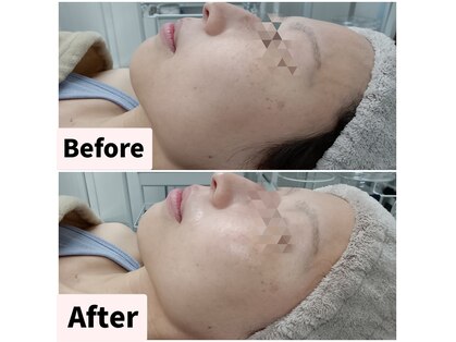 レン(Ren)の写真