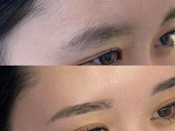 アイルーム 大宮店(eyeroom)/額Wax脱毛