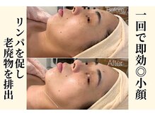 エトレ(etre)の雰囲気（三宮/毛穴/毛穴レス/毛穴ケア/毛穴改善/毛穴洗浄/ピーリング脱毛）