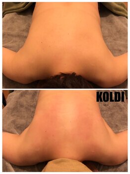 コルディ(KOLDI)/ボディコルギ+キャビテーション