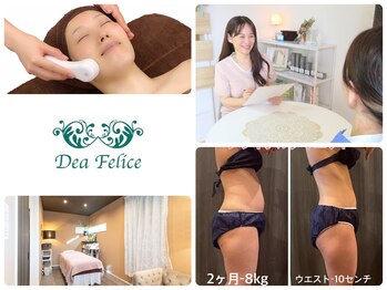 ディア フェリーチェ(Dea Felice)