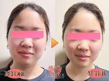 ヴィオーデ 自由が丘店/小顔、リンパ、ヘッドスパ、整体