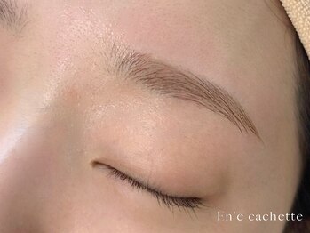 エンカシェット 代官山(En’e cachette)/【矯正美眉】すっぴん美人♪