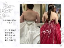 アモリール(Amolir)/ブライダルエステでマイナス9kg!