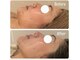 リベラ(Re:BELLA)の写真
