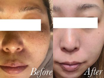 ローズルート(Rose route)/