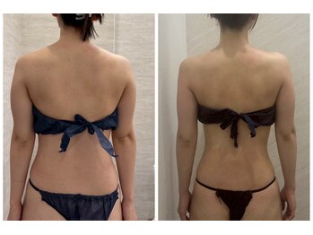 ルナグランデ 心斎橋店(Luna grande.)/ブライダルはお任せください