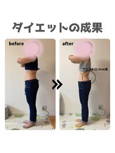 ファミール鍼灸整体院(famille鍼灸整体院)/体重マイナス10.4kg