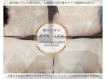 エレナ(ELENA)の雰囲気(【背中美人になれる】ケアしずらい背中もしっかりケアします!)