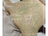 夏前に★【背中上部】陶肌トリートメント/ハーブピーリングOP1つプレゼント