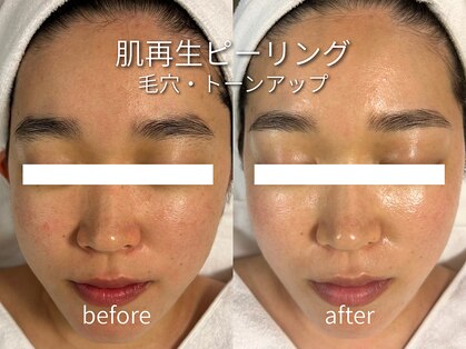 デディア(dedia)の写真