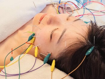ミリグラム(mg)の写真/お顔の印象が変わる！自然な美しさが手に入る◎４０代からの美容鍼灸サロン！初めての方にもオススメ◎