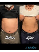 アッヴェリーレ(A'bbellire)/電磁パルス Before/After