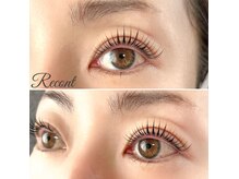 リコンテ(Recont)