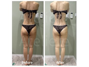 アトリエール(Ateliere)/気になる下半身に…!!