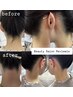 【ワックス脱毛】うなじ・襟足・首下まで　ワックス＋鎮静つき♪