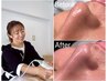 人気NO.1【美脳小顔矯正＋毛穴洗浄＋エレクトロポレーション】通常18,900円