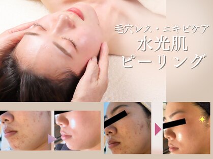 ボンシェリの写真