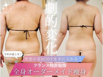 プリマ(Prima)の写真