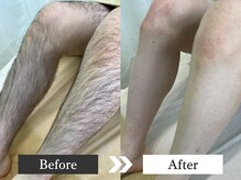 メンズオージー 岡山中区(men's O.G)の雰囲気(ワックス脱毛は自己処理不要!仕事帰りにもフラット寄れる◎)