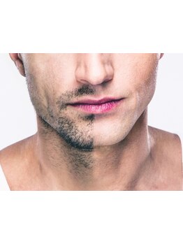 メンズフェイシャル