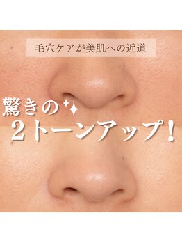 まつげ屋リュ( Ly)/ハイドラフェイシャル