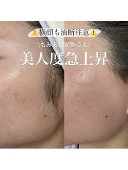 ドラセナ トータルビューティー(Dracaena Total Beauty)/もみあげワックス